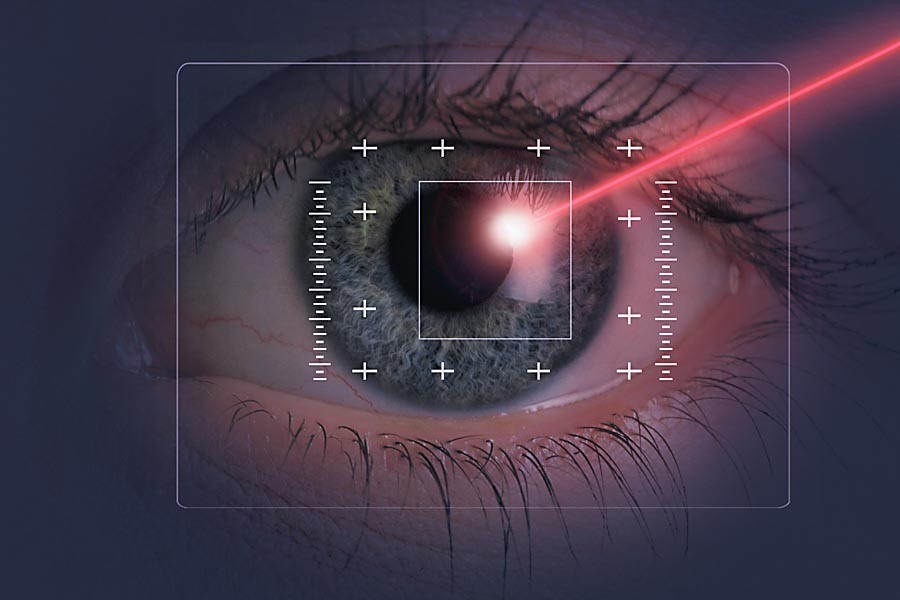 Лазерная коррекция зрения: перспективы, преимущества и риски