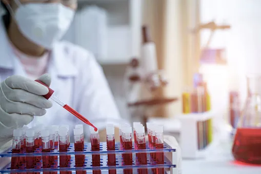 Плазма – өмір сүру мүмкіндігі: донорлар неге маңызды және өмірлік маңызы бар препараттардың қауіпсіздігі қалай қамтамасыз етіледі